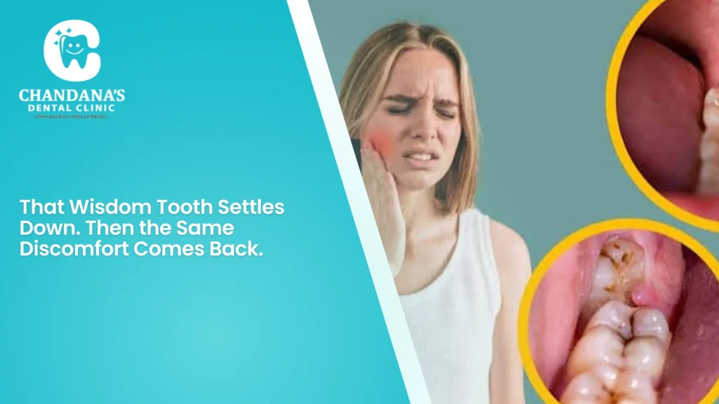 That Wisdom Tooth Settles Down. Then the Same Discomfort Comes Back.