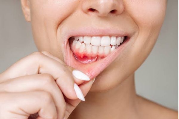 Gum Disease Treatment