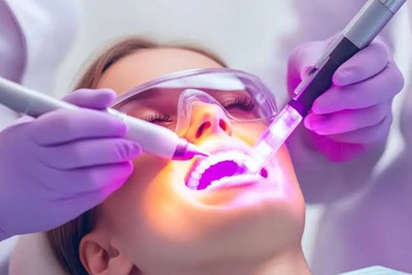 Laser Dentistry