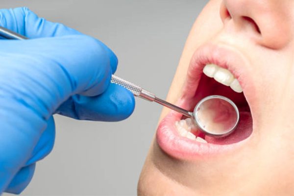 Preventive Dental Care