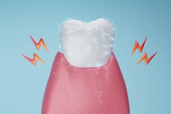 Sensitive Teeth Treatment