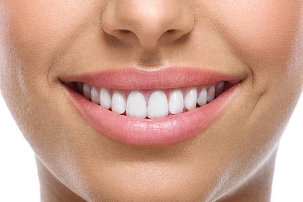 Teeth Whitening